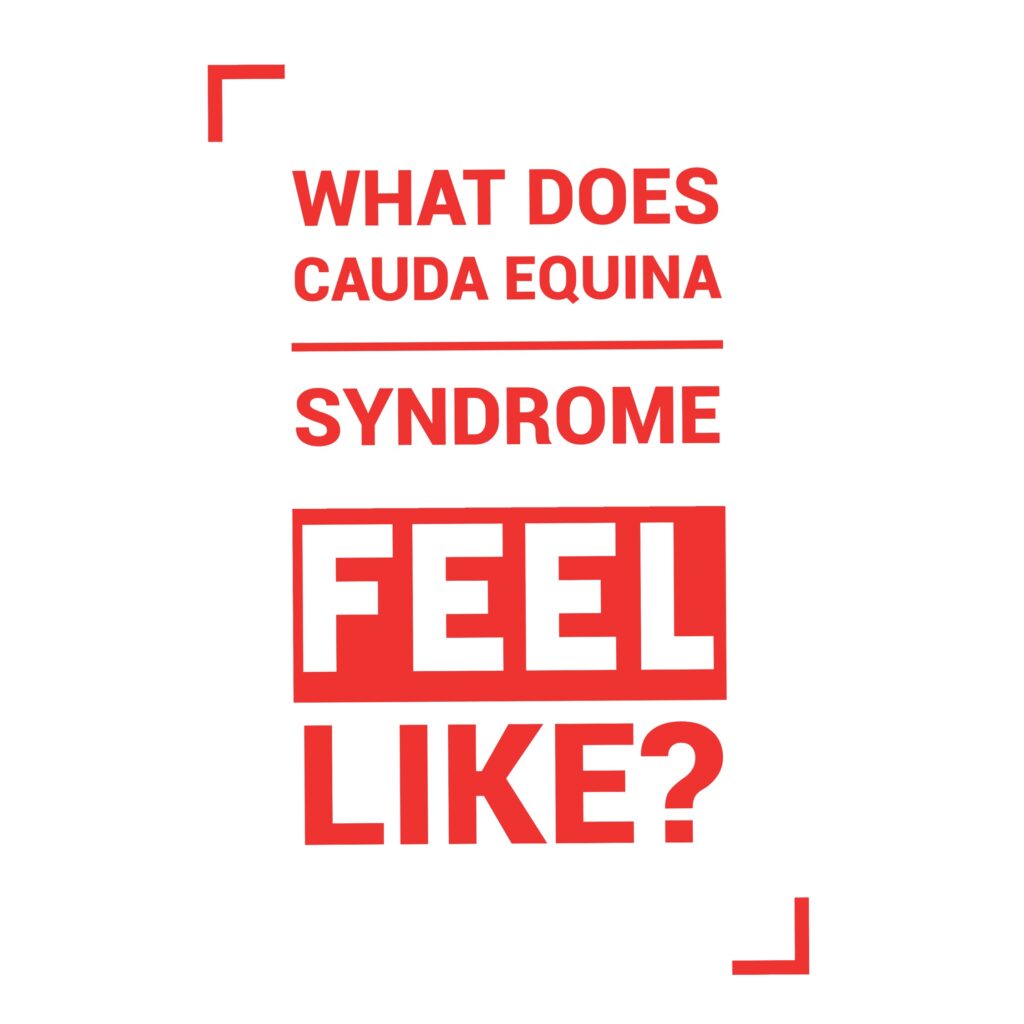 What Does Compression of The Cauda Equina Feel like?