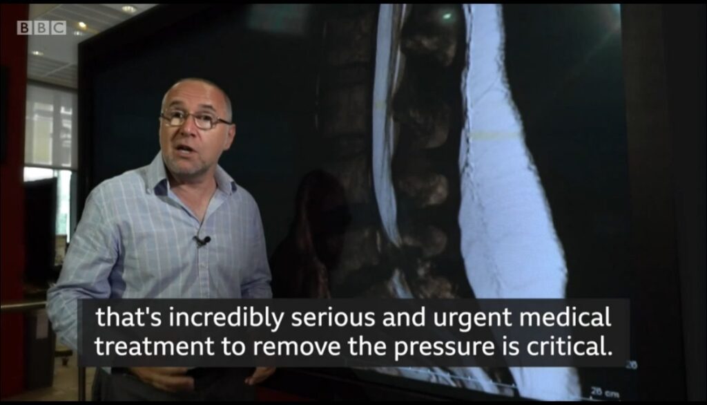 An Open Letter To Clive Coleman and the BBC Team