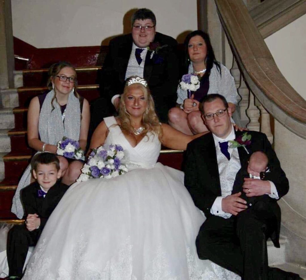 Cauda Equina and pregnancy